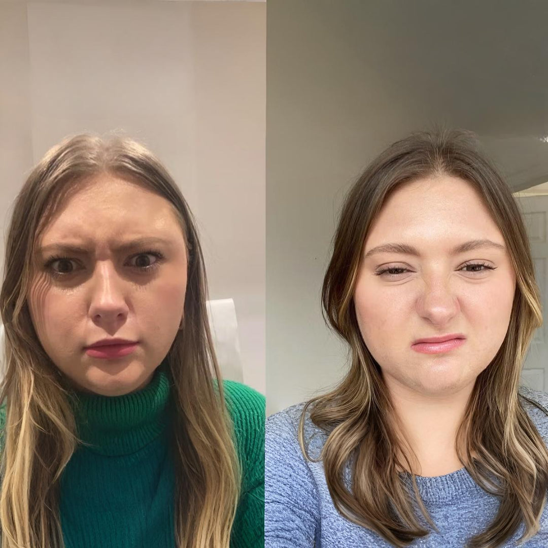 Daxxify – Advanced Wrinkle Smoother | 14 per unit